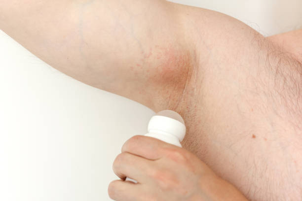 Pimples Under the Arm Causes